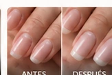 Antes y después 3