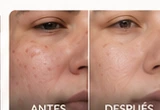 Antes y después 4