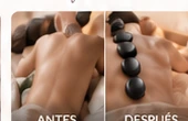 Antes y después 5